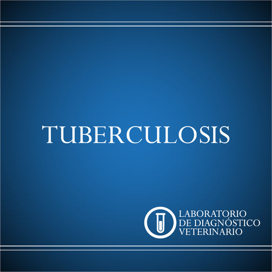 Diagnóstico Tuberculosis